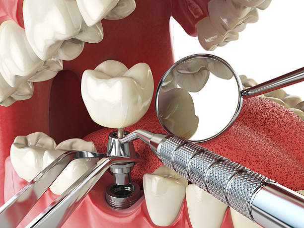 Tooth Infection Emergency Dentist in MA